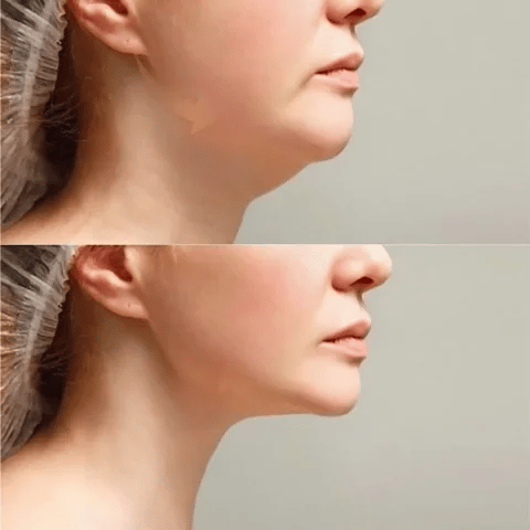 Pack Belleza Facial